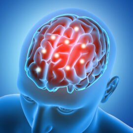 Neurology