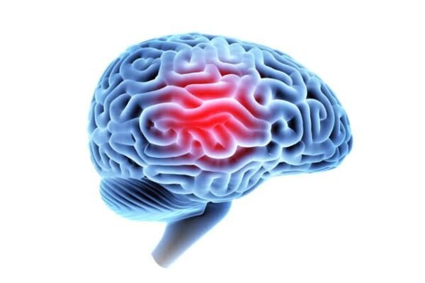 Traumatic brain injury